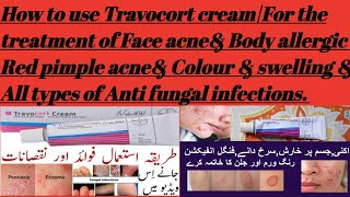 How to use Travocort creamFor the treatment of Face acneampBody allergic Red pimples acne reactions [upl. by Kiyohara]