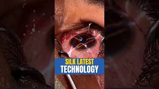 SILK Latest Technology For Specs Removal [upl. by Dranek627]