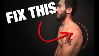 How to Fix Rounded Shoulders GONE IN 4 STEPS [upl. by Ahsitniuq]