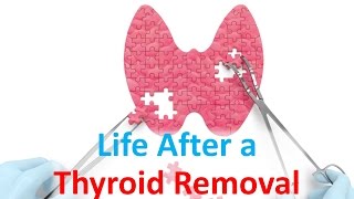 Life After a Thyroid Removal [upl. by Ause]