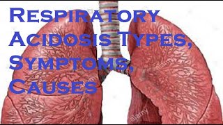 Respiratory Acidosis Types Symptoms Causes [upl. by Elise749]