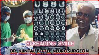 Spreading Smile  Chronic Subdural Hematoma  SDH  Complete Recovery  NEET UG  NEET PG  NEET SS [upl. by Rosenzweig]