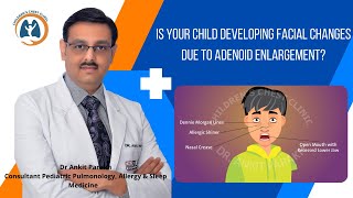 Facial changes due to Adenoid enlargement in children I Dr Ankit Parakh Child Pulmonologist [upl. by Campos]