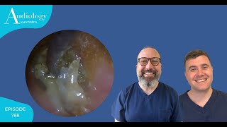 CRUSTY HARD EAR INFECTION REMOVAL  EP788 [upl. by Salangi73]