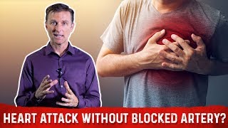 Heart Attack Without Clogged Arteries – DrBerg On Myocardial Infarction amp Heart Problems [upl. by Yorgo]