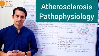 Atherosclerosis Pathophysiology  Etiology and Pathogenesis of Atherosclerosis [upl. by Ainahs991]