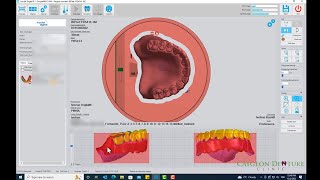 Nesting CUDCLD for Milling on Ivoclars PM7 [upl. by Ennovi891]