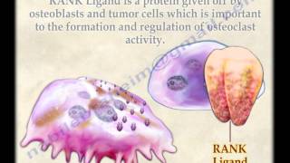 Osteoclasts  Everything You Need To Know  Dr Nabil Ebraheim [upl. by Enomahs565]