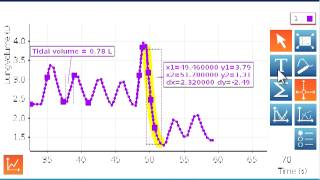 Spirometer Part 2 [upl. by Hayn]