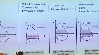 sft solunumfonksiyontesti isg işyerihekimi [upl. by Hinkle]