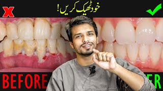 Never Get GUM DISEASE AGAIN after this Home Remedy  InqalabFareed [upl. by Jehias686]