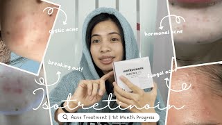 Accutane Journey  One Month Progress Road to Clear Skin [upl. by Ttenaej801]