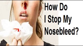 How Do I Stop My Nosebleed كيف أوقف نزيف الأنف [upl. by Esmond]