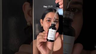 Minimalist 10 Vitamin C Serum Review 7 Days Challenge minimalist vitamincserum ashortsaday [upl. by Joellyn961]