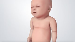 Infant Distress Warning Signs Grunting Baby Sound [upl. by Robbi547]