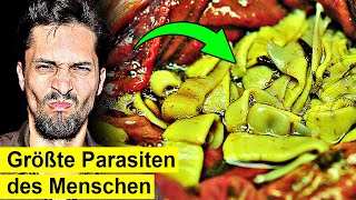 7 Meter Wurm plötzlich im Bauch Ein gefährlicher Parasit [upl. by Slater]