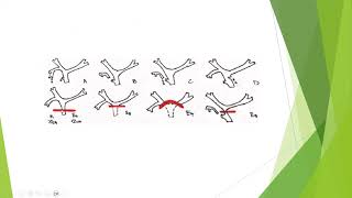 biliary leaks  approach to diagnosis and treatment [upl. by Randa316]