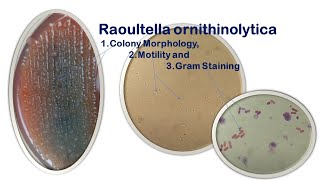 Raoultella ornithinolytica Colony Morphology Motility and Gram Staining [upl. by Oram]