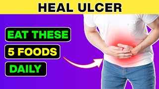 How I Cured My Stomach Ulcer with Diet A Personal Journey [upl. by Naugal560]