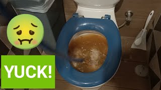 Blocked Drain 14  DISGUSTING Blocked Toilet  How to UNCLOG a Toilet [upl. by Wilton]