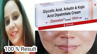 Demelan Cream Review  Best Cream For Pigmentation  Honest Review After One Month of Using [upl. by Gottwald]