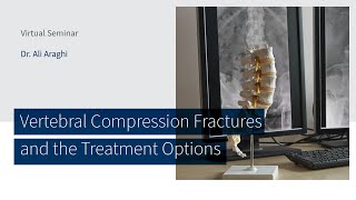 Vertebral Compression Fractures and the Treatment Options with Dr Ali Araghi [upl. by Arotal785]