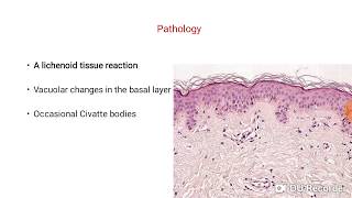 Dermatomyositis Part 3 [upl. by Amathist]