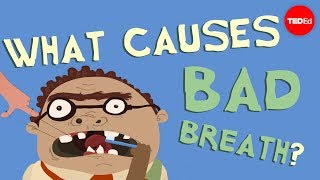 What causes bad breath  Mel Rosenberg [upl. by Htebaras]