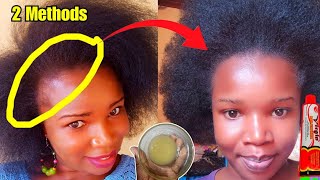 REGROW YOUR EDGES amp BALD SPOTS The Natural Way  2 METHODS  VIRGIN HAIR FERTILIZER [upl. by Drobman]