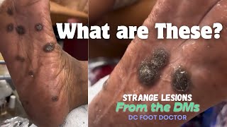 Strange Lesions From The DMs Episode 5 [upl. by Delos]