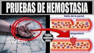 🩸Pruebas de la Hemostasia Primaria y Secundaria  ¿Que son ¿para qué Sirven y ¿cómo se realizan❤️ [upl. by Dinah939]