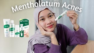 Cara berkesan hilangkan jerawat  Mentholatum Acnes [upl. by Tnerual703]