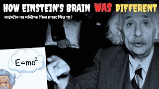 How Einsteins Brain was Different  आइंस्टीन का मस्तिष्क किस प्रकार भिन्न था [upl. by Ocimad]