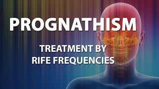 Prognathism  RIFE Frequencies Treatment  Energy amp Quantum Medicine with Bioresonance [upl. by Ahsirt326]