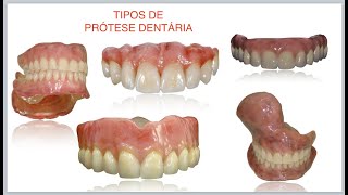 Tipos de prótese dentária fixas e removíveis [upl. by Burner]