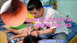 Dụng cụ lấy ráy tai có camera FIKO NE3  Ngoáy tai có camera [upl. by Trenton]