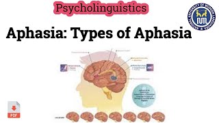 Aphasia  Types of Aphasia [upl. by Kurth575]