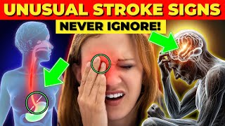 7 Uncommon Signs of Strokes You Should Know About [upl. by Iderf407]