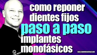 DIENTES NUEVOS en 72 HORAS con IMPLANTES MONOFÁSICOS PROCESO PASO a PASO HOY ES LA MEJOR OPCIÓN [upl. by Jazmin]