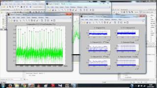 ECG Signal Processing in MATLAB  Detecting RPeaks Full [upl. by Cornelie253]