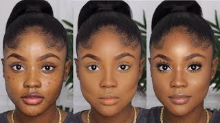 HOW TO COVER UP BREAKOUTS amp SCARS WITHOUT LOOKING CAKEY OR ASHYKAISERCOBY [upl. by Terencio724]