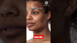 Cream for Dark spots pigmentation blemishes uneven skintone tanning [upl. by Akimrej]