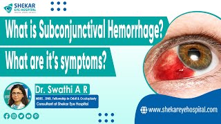 Subconjunctival Hemorrhage Blood in Eye  Symptoms Signs amp Causes of Subconjunctival Hemorrhage [upl. by Radu]