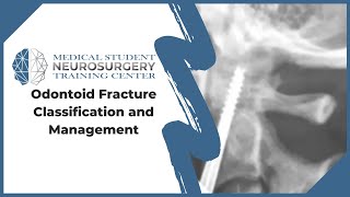 Odontoid Fracture Classification and Management [upl. by Nessy993]