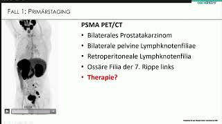 Wolfgang Fendler Essen DE Nuklearmedizinische Theranostik des Prostatakarzinoms [upl. by Littell]