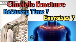 clavicle fracture recovery time  Clavicle Fracture recovery exercises  collar bone  in Hindi [upl. by Aihsaei]