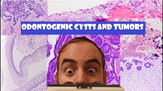 The ULTIMATE Odontogenic Cyst and Tumor Review Video [upl. by Rauch890]