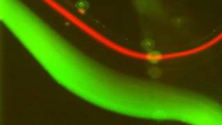 Fluorescence microscopy of microbeads [upl. by Damha]