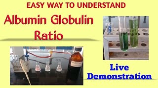 Albumin globulin ratio  Total protein estimation  Biuret method  Albumin estimation  BCG method [upl. by Procter958]