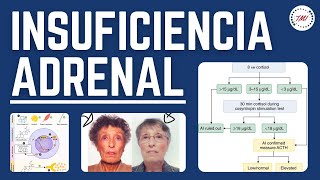 Insuficiencia Adrenal  Fisiopatología Clínica Diagnóstico Tratamiento y Crisis Adrenal [upl. by Attenweiler435]